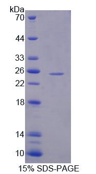 Recombinant Hydroxymethylglutaryl Coenzyme A Synthase 2, Mitochondrial (HMGCS2)