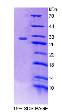 Recombinant Propionyl Coenzyme A Carboxylase Beta (PCCb)