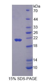 Recombinant Peroxisomal D3, D2-Enoyl Coenzyme A Isomerase (PECI)