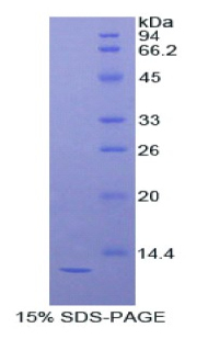 Recombinant Diazepam Binding Inhibitor (DBI)