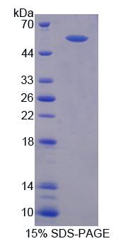 Recombinant Regulator Of G Protein Signaling 6 (RGS6)