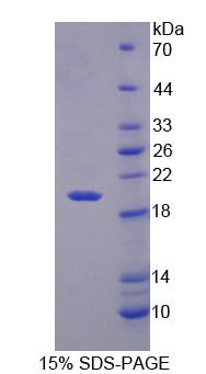 Recombinant Regulator Of G Protein Signaling 7 (RGS7)