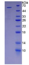 Recombinant Killer Cell Immunoglobulin Like Receptor 2DS2 (KIR2DS2)