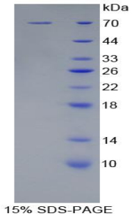 Recombinant Killer Cell Immunoglobulin Like Receptor 2DL2 (KIR2DL2)