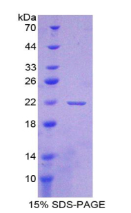 Recombinant Apolipoprotein A1 Binding Protein (APOA1BP)