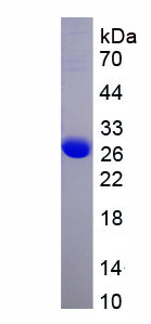 Recombinant Apolipoprotein A1 Binding Protein (APOA1BP)