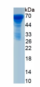 Recombinant Lipolysis Stimulated Lipoprotein Receptor (LSR)