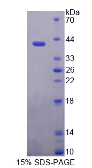 Recombinant Keratin 6C (KRT6C)