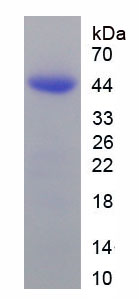 Recombinant Glutamine synthetase (GS)