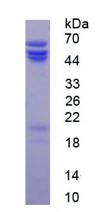 Recombinant Kynureninase (KYNU)