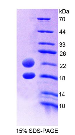 Recombinant Arginine Vasopressin Induced Protein 1 (AVPI1)