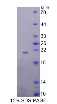 Recombinant Deoxythymidylate Kinase (DTYMK)