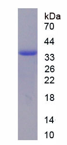 Recombinant Arginase II (Arg2)