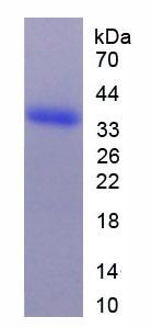 Recombinant Arginase II (Arg2)