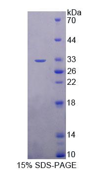 Recombinant Topoisomerase III Beta (TOP3b)