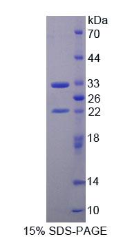 Recombinant Topoisomerase II Binding Protein 1 (TOPBP1)