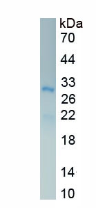 Recombinant Thrombospondin 2 (THBS2)