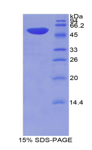 Recombinant Thrombospondin 2 (THBS2)