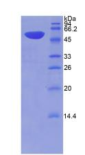 Recombinant Thrombospondin 2 (THBS2)