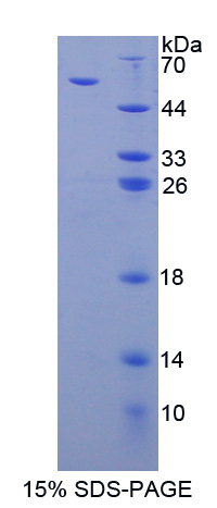 Recombinant Thrombospondin 3 (THBS3)