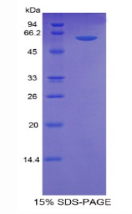 Recombinant Thrombospondin 4 (THBS4)