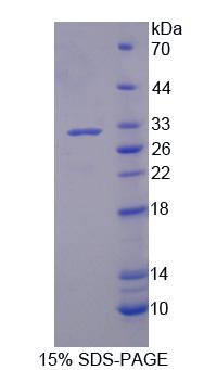 Recombinant Phospholipase A2, Group III (PLA2G3)