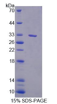 Recombinant Phospholipase C Delta 1 (PLCd1)