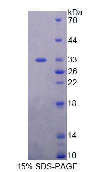 Recombinant Phospholipase C Eta 1 (PLCh1)