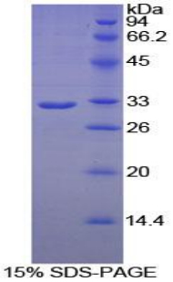 Recombinant Phospholipase A2 Receptor 1 (PLA2R1)