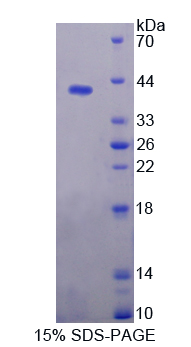 Recombinant Phospholipase A2 Receptor 1 (PLA2R1)