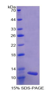 Recombinant Alanine Aminotransferase 2 (ALT2)