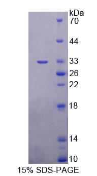 Recombinant Alanine Glyoxylate Aminotransferase 2 (AGXT2)