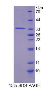 Recombinant Tyrosine Aminotransferase (TAT)