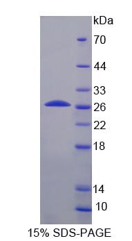 Recombinant Insulin Receptor Related Receptor (INSRR)