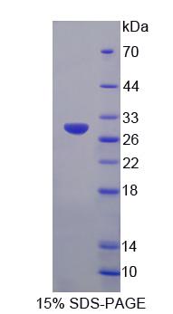 Recombinant Insulin Receptor Substrate 4 (IRS4)