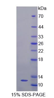 Recombinant General Transcription Factor IIH, Polypeptide 5 (GTF2H5)