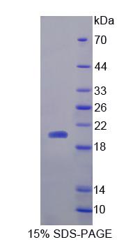 Recombinant 5',3'-Nucleotidase, Cytosolic (NT5C)