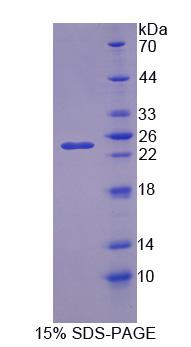 Recombinant 5'-Nucleotidase, Mitochondrial (NT5M)