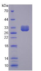 Recombinant Liver Receptor Homolog 1 (LRH1)