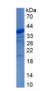 Recombinant Transcription Elongation Factor A1 (TCEA1)