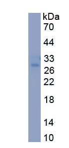 Recombinant Adrenergic Receptor Beta 3 (ADRb3)