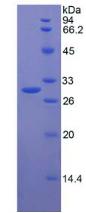 Recombinant Dimethylarginine Dimethylaminohydrolase 2 (DDAH2)