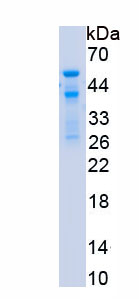 Recombinant Protein Arginine Methyltransferase 1 (PRMT1)