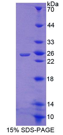 Recombinant CREB Regulated Transcription Coactivator 1 (CRTC1)
