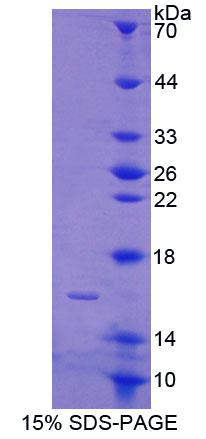 Recombinant Calcium Binding Protein 2 (CABP2)
