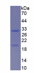 Recombinant Protein Phosphatase 1, Regulatory Subunit 1B (PPP1R1B)
