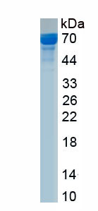 Recombinant Neurofilament, Light Polypeptide (NEFL)