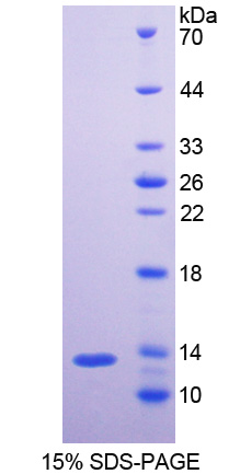 Recombinant Neurofilament, Light Polypeptide (NEFL)