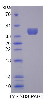 Recombinant Protocadherin Beta 16 (PCDHb16)