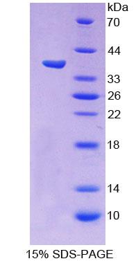 Recombinant Protocadherin Beta 15 (PCDHb15)